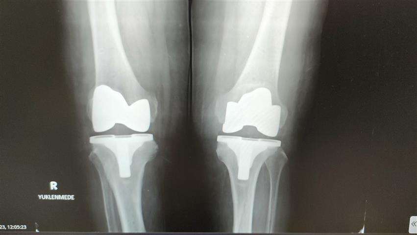 Diz Agrilari (Small)