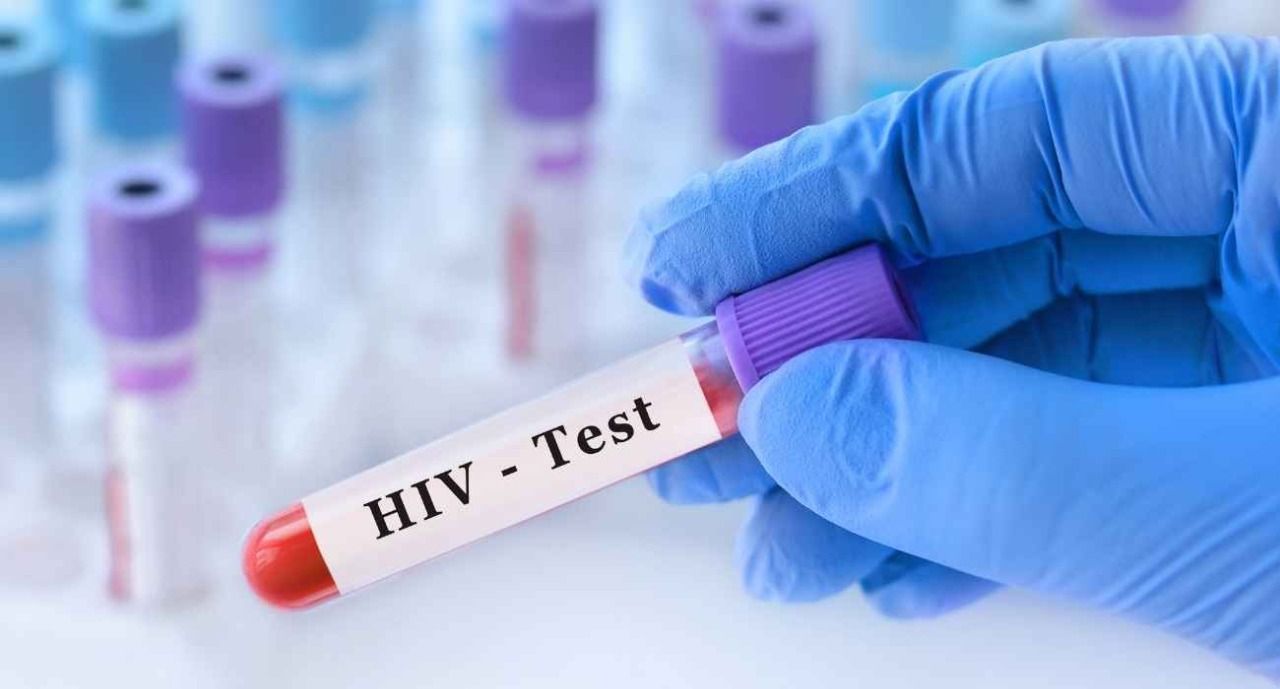 Aids Testi