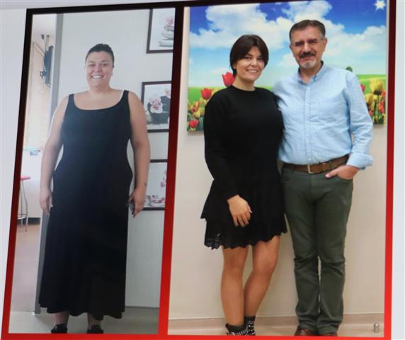 Ameliyatla 55 Kilo Veren Nihan Hemsire 22513 (2) (Small)