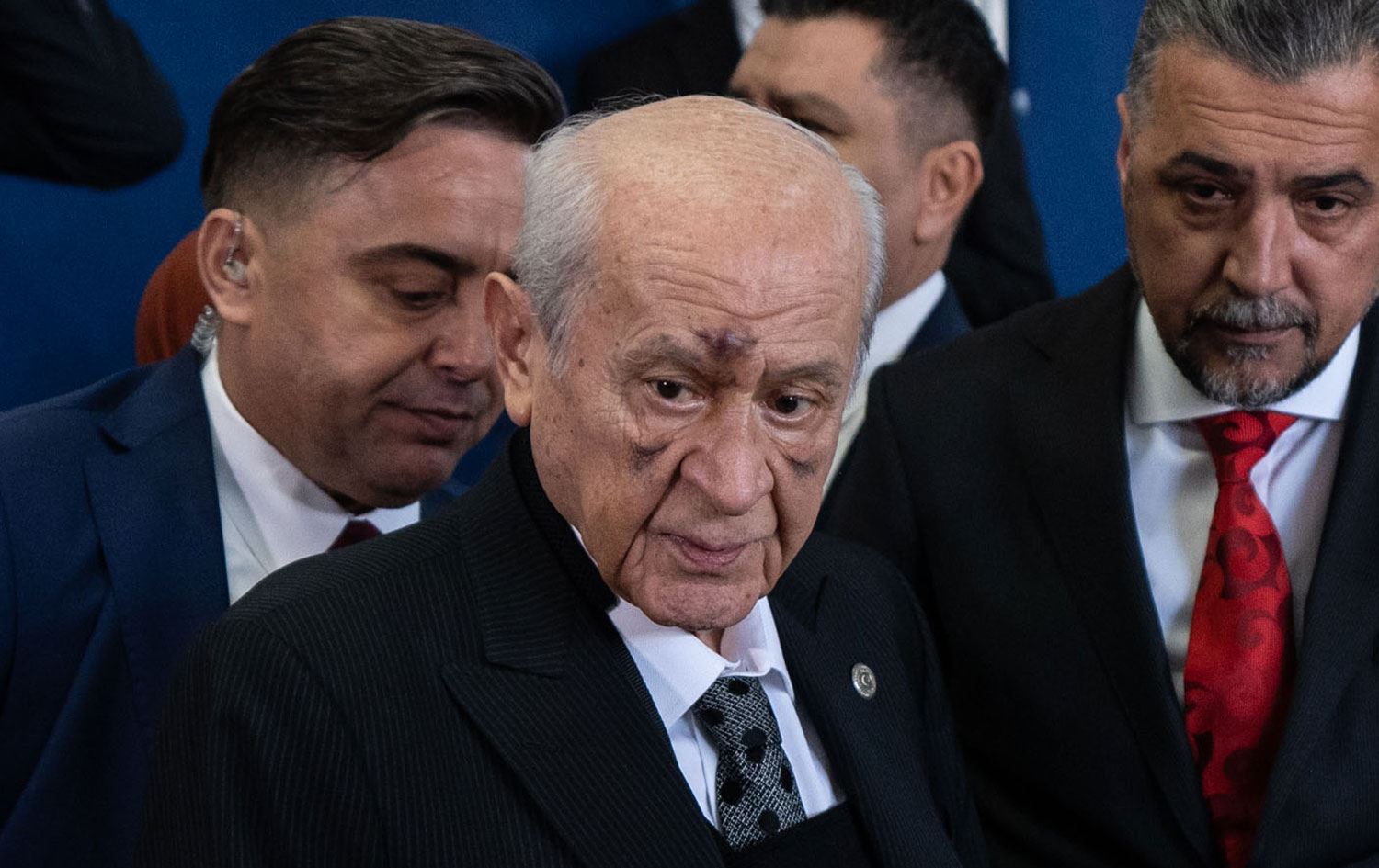 Devtlet Bahceli Yara