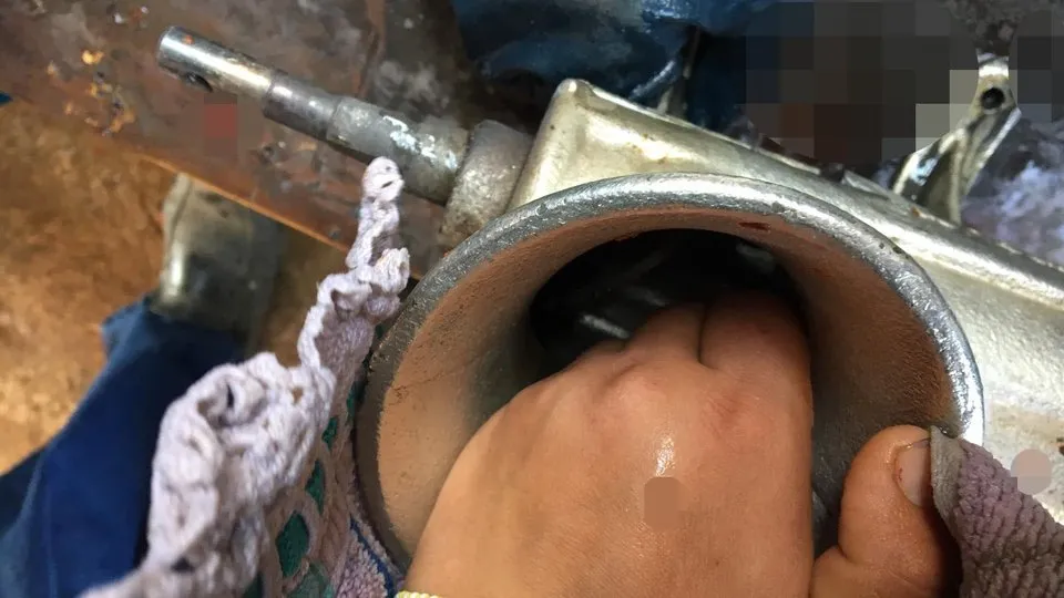 Elini Kıyma Makinesine Kaptıran Genç Kız Ağır Yaralandı