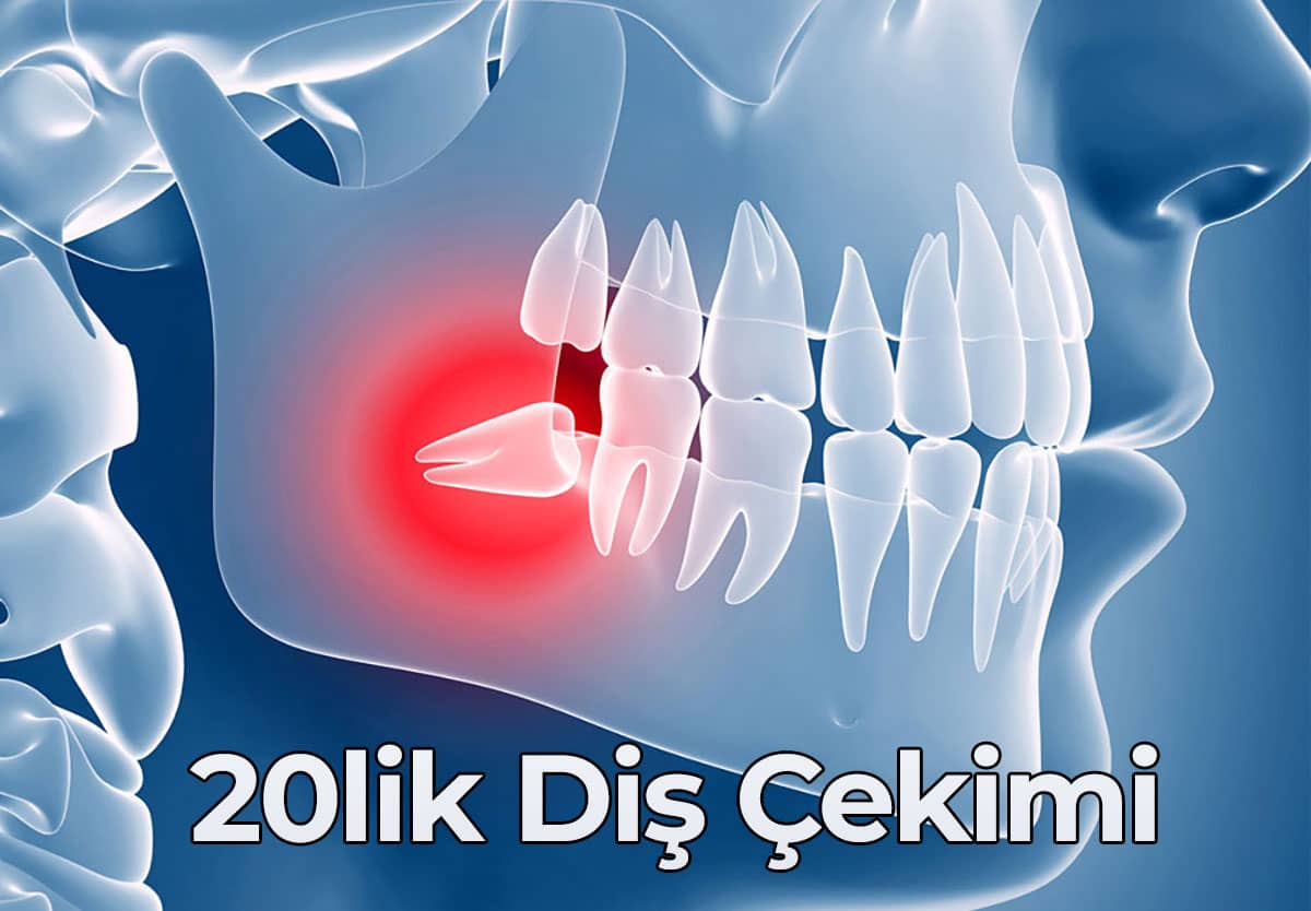 20 Lik Diş Çekimi Korkusu