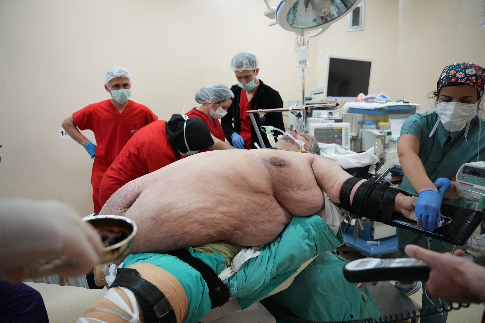 310 Kiloluk Hasta, Sedyede Geldiği Hastaneden Yürüyerek Çıktı (5)