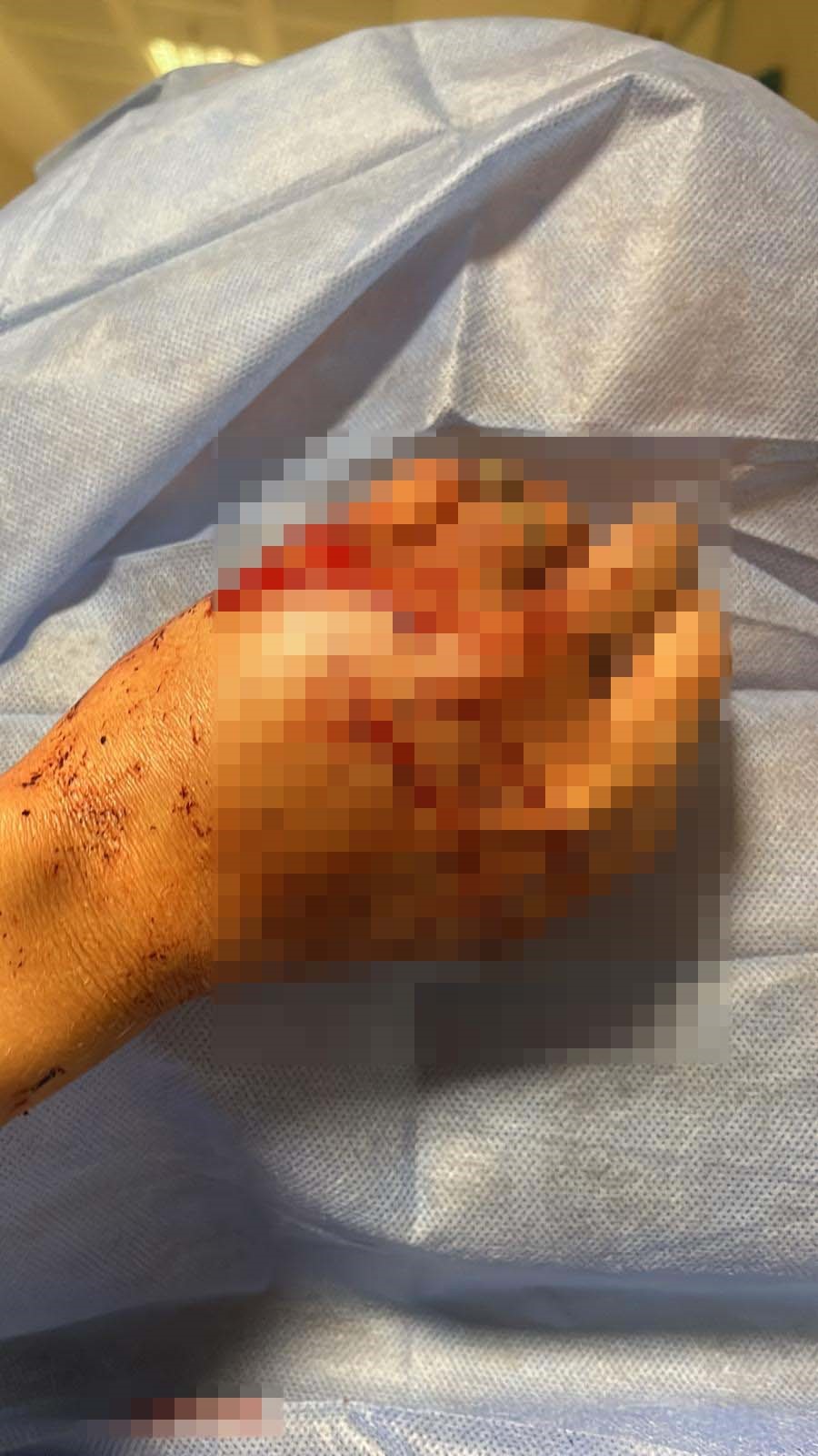 Antalya'da Uzaklaştırma Kararı Aldıran Kadın Dehşeti Yaşadı (4)