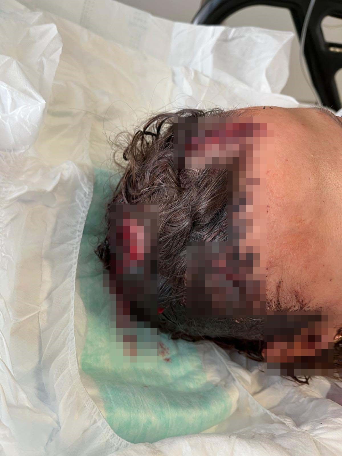 Antalya'da Uzaklaştırma Kararı Aldıran Kadın Dehşeti Yaşadı (5)