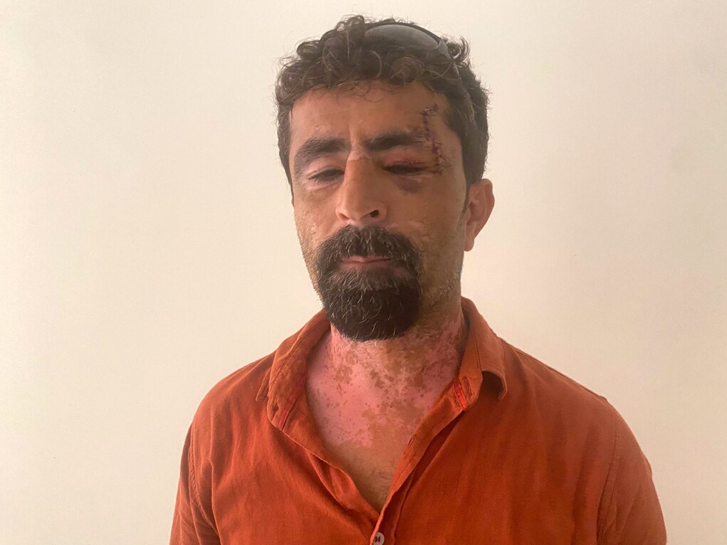 Antalya'da Öfkeli Damat Kayınpederini Hastanelik Etti (2)