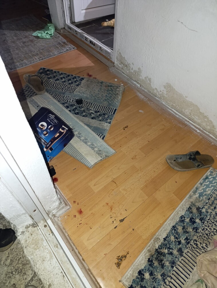 Antalya'da Öfkeli Damat Kayınpederini Hastanelik Etti (5)