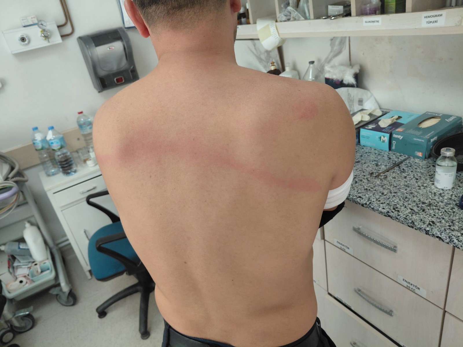 Belediye Başkanı Zabıtayı Sopayla Dövdü (2)