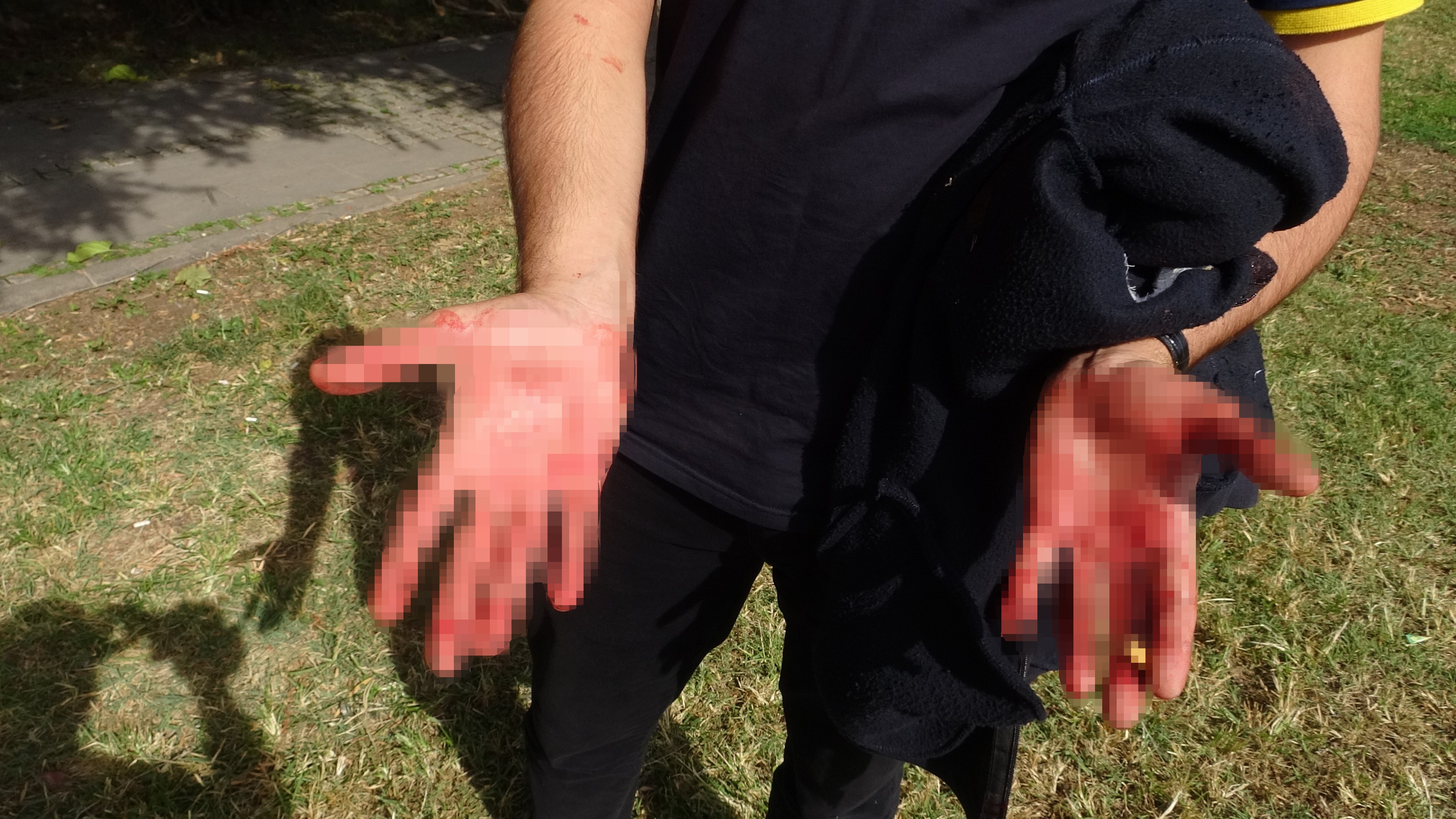 Akıl Almaz Olay Antalyada Yaşandı (4)