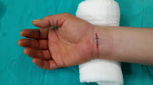 Antalya ‘El Cerrahisi’ Için Talepte Bulundu (1)-3