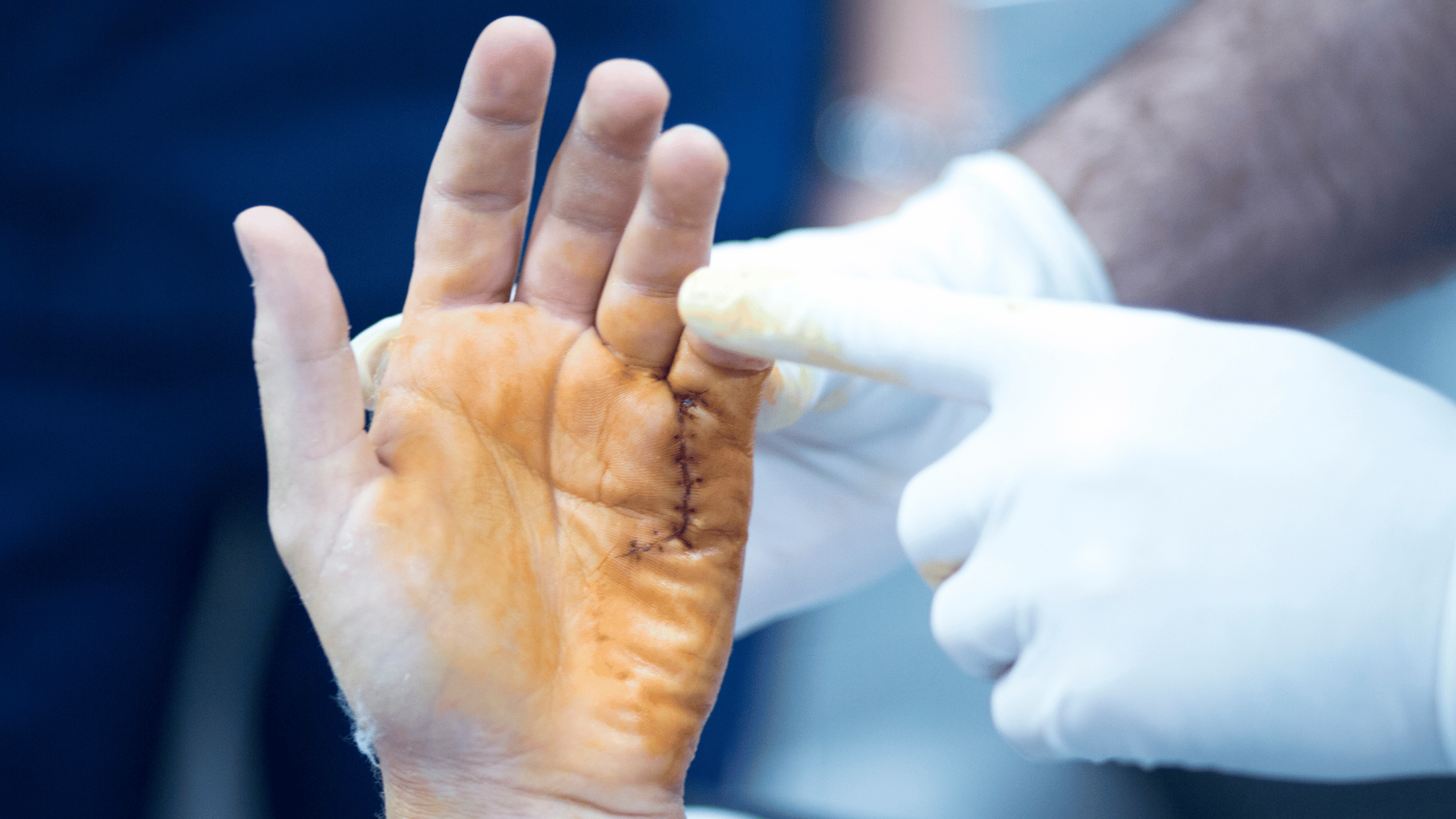 Antalya ‘El Cerrahisi’ Için Talepte Bulundu (1)