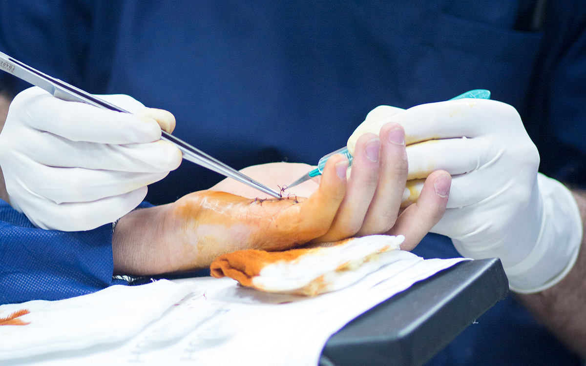 Antalya ‘El Cerrahisi’ Için Talepte Bulundu (2)