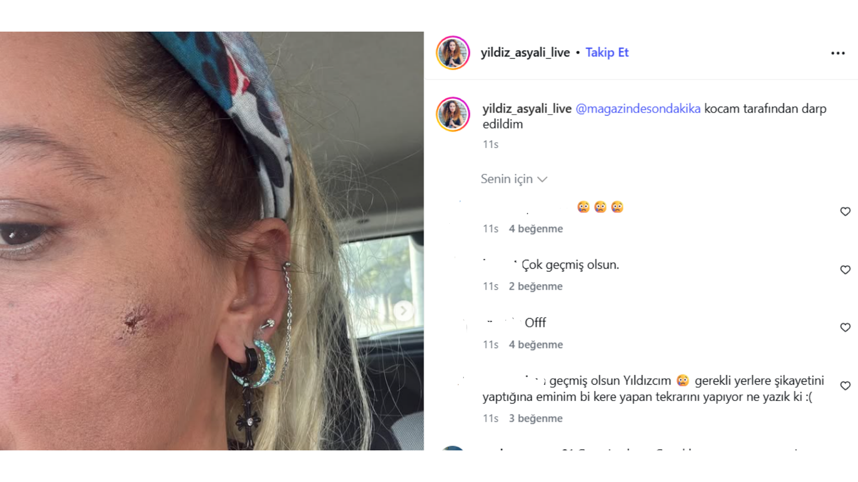 Yildiz Asyali Instagram