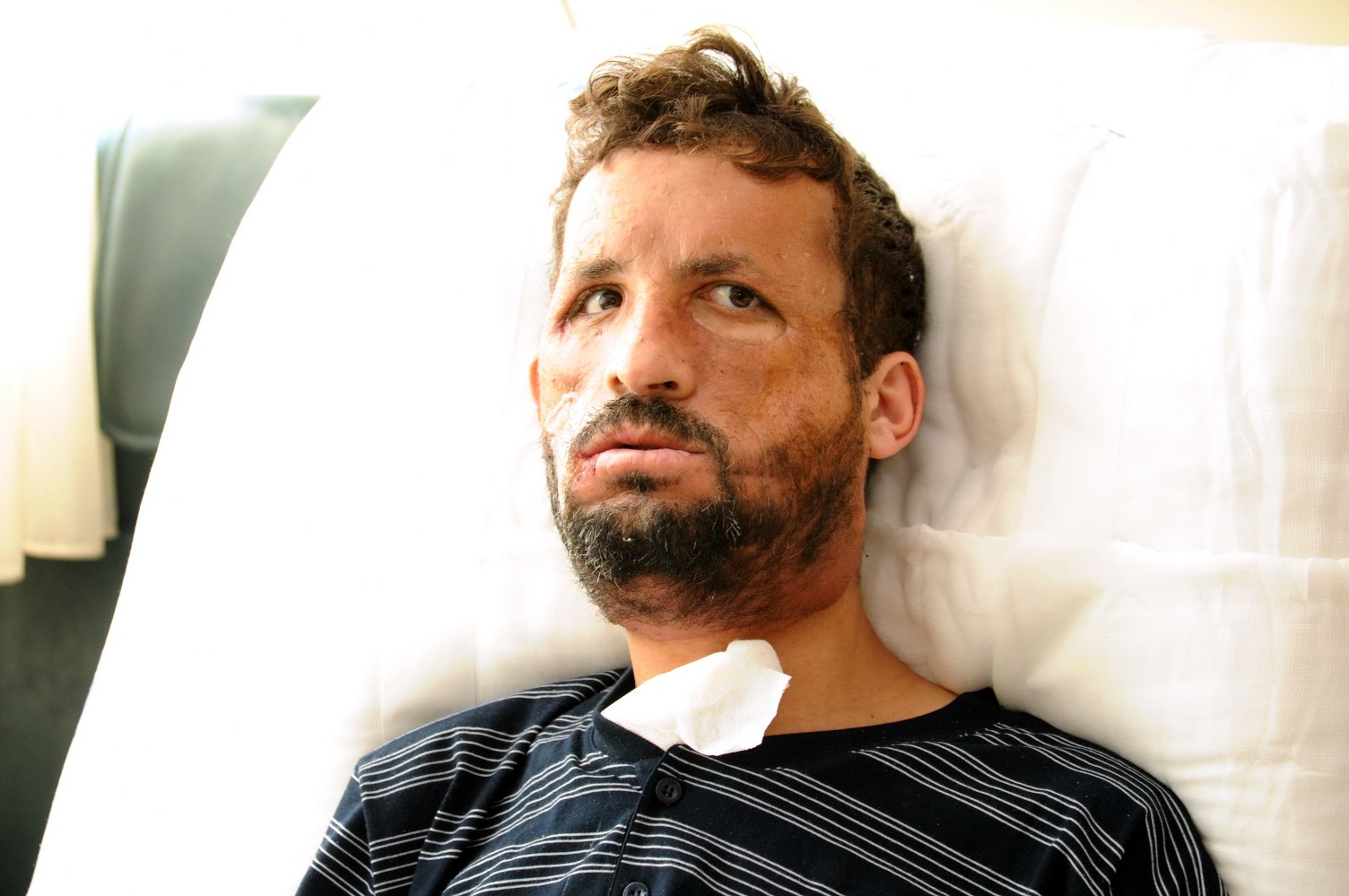 Hayata 14 Yıldır Başka Bir Yüzle Bakıyor (7)