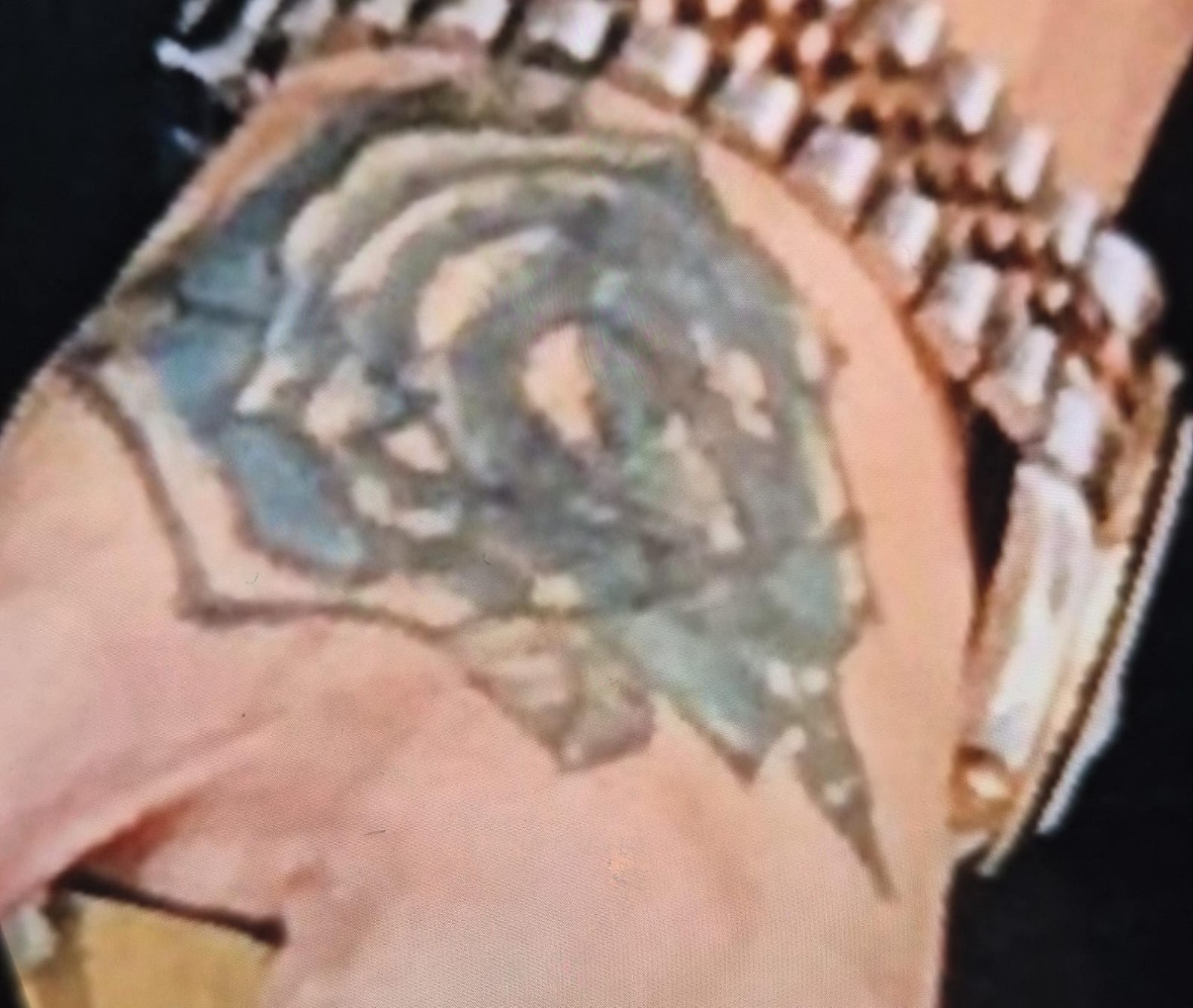 Hevesle Yaptırdığı Dövme Kabusu Yaşattı (3)