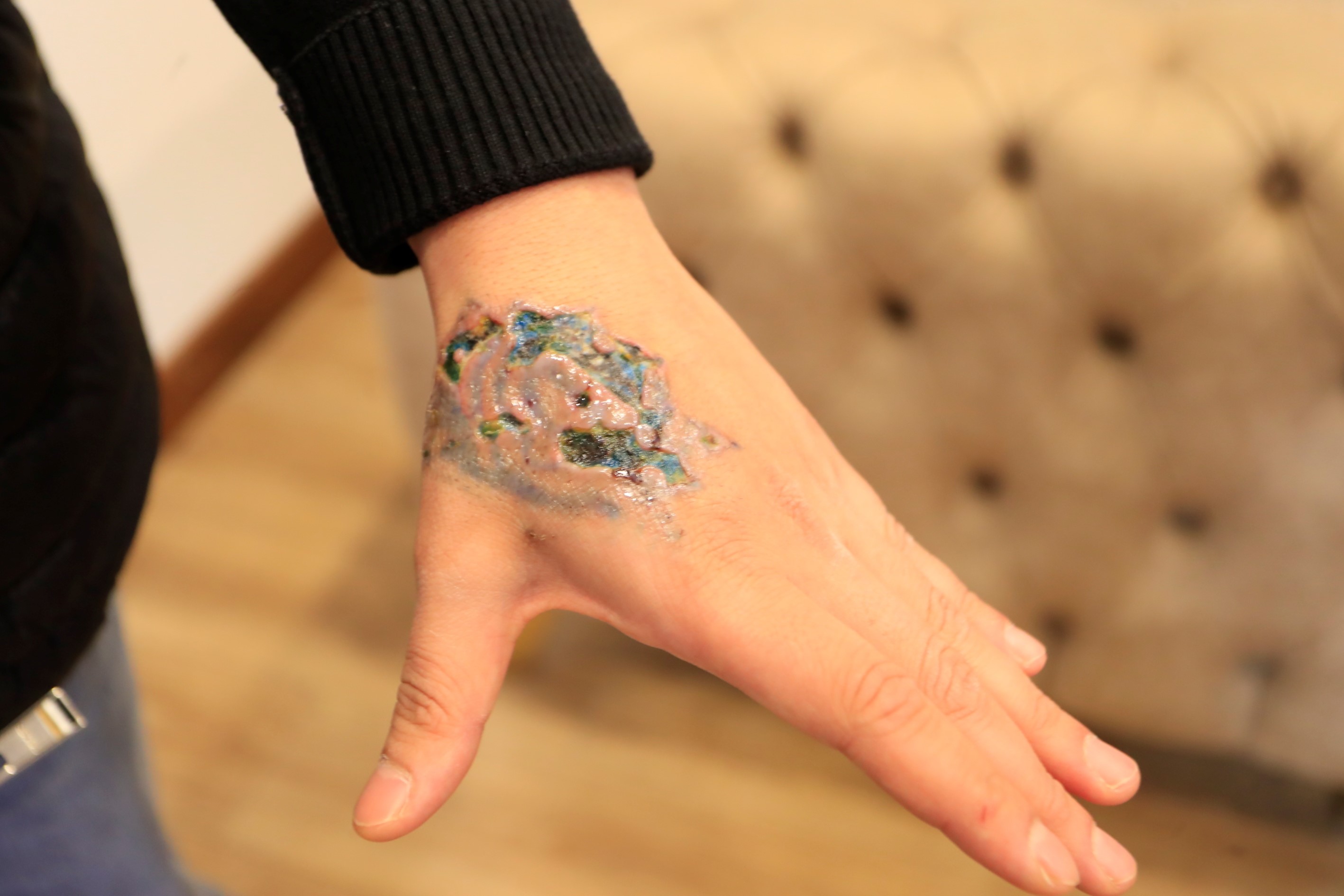 Hevesle Yaptırdığı Dövme Kabusu Yaşattı (4)