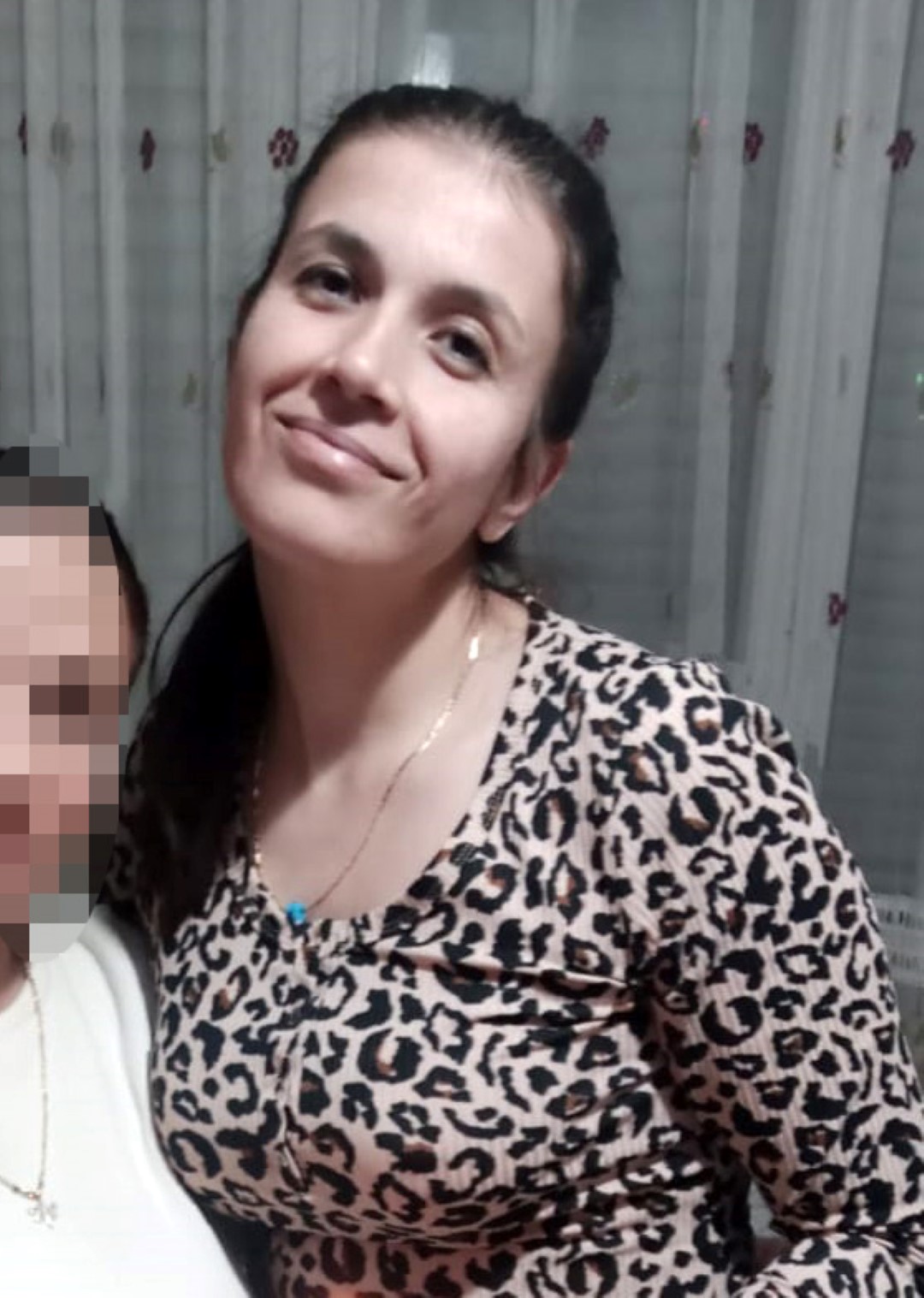 Kazada Kopup Dikilemez Denilen Uzuvlar 1156912 343510 (Large)