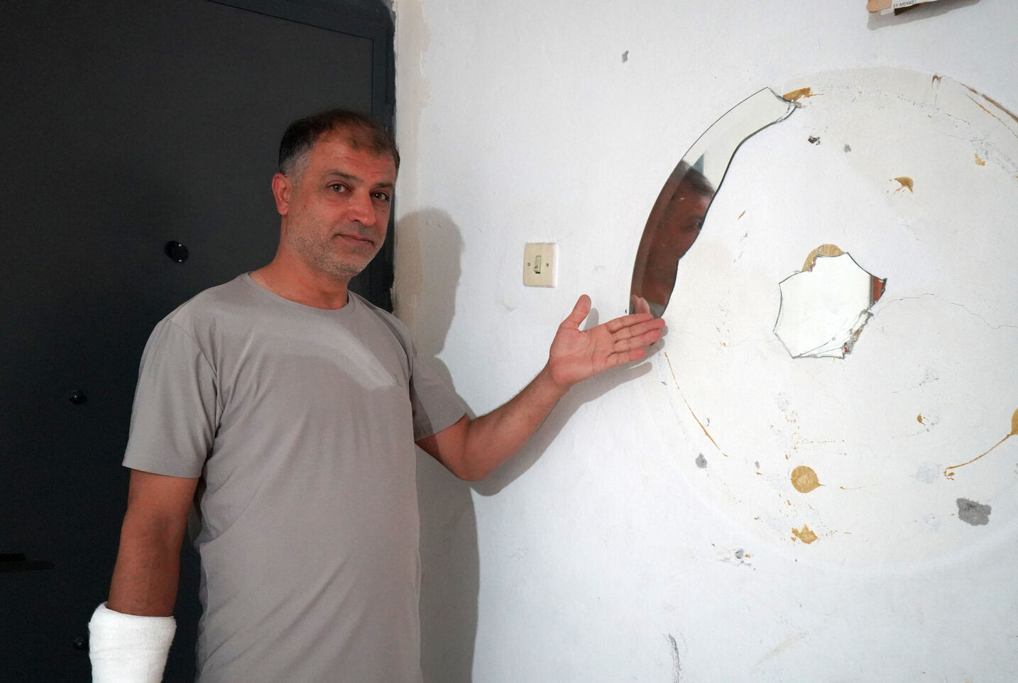 Antalya’da Otizmli Gençte Artan Şiddet Aileyi Tüketti (2)