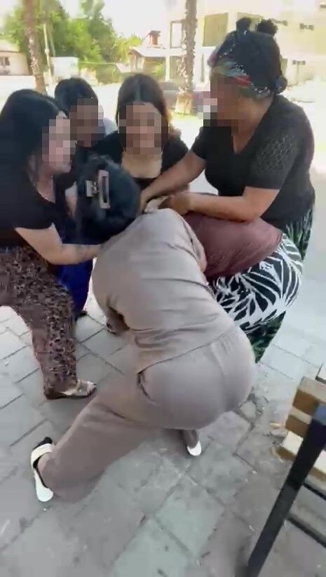 Antalya’da Sokak Ortasında Saldırıya Uğrayan Kadın O Anları Anlattı (2)