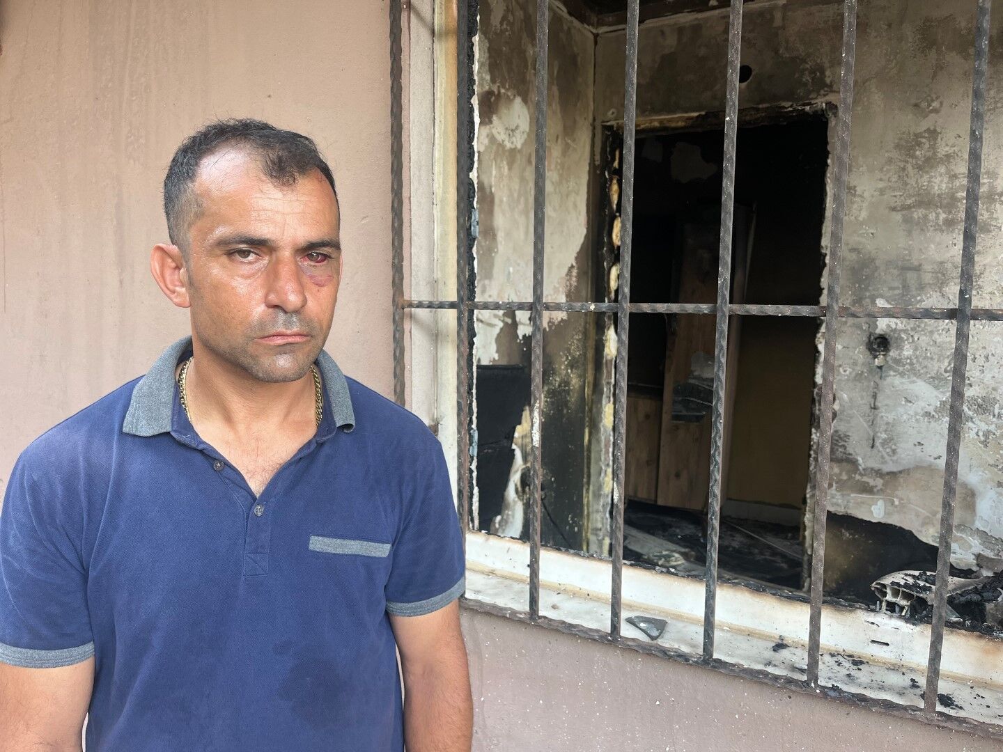Antalya’daki Yangında Itfaiye Eri Çocuğu Yalnız Bırakmadı Görenler Duygulandı (5)