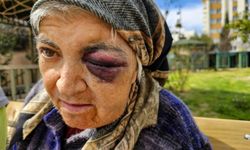 Engelli kadının iddiaları vicdanları sızlattı… Bakın engelli kadına neler yapmışlar