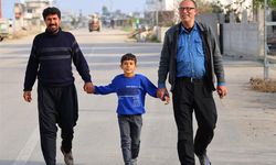 Hayata çift renk bakıyor, görenler hayrete düşüyor