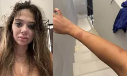 Merve Taşkın’ı öyle bir dövdü ki, fotoğrafları şoke etti