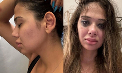 Merve Taşkın’a işkence gibi dayak, eski sevgilisi tanınmaz hale getirdi