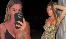 Hadise kıpkırmızı kaldı, yaz sezonunu açan Hadise’nin ilginç görüntüsü dillere düştü, güneş kremi yok mu?