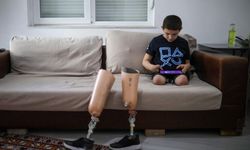 Kredi ile alınan protez bacaklara icra geldi… Aras yetkililere seslendi