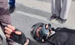 Çocuğunun korktuğunu görünce kendi acısını bir kenara attı