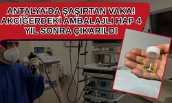 Antalya’da şaşırtan vaka! Akciğerdeki ambalajlı hap 4 yıl sonra çıkarıldı