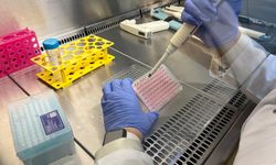 Parkinson’da bağırsak- beyin iletişimi çip üstü organ teknolojisiyle araştırılıyor