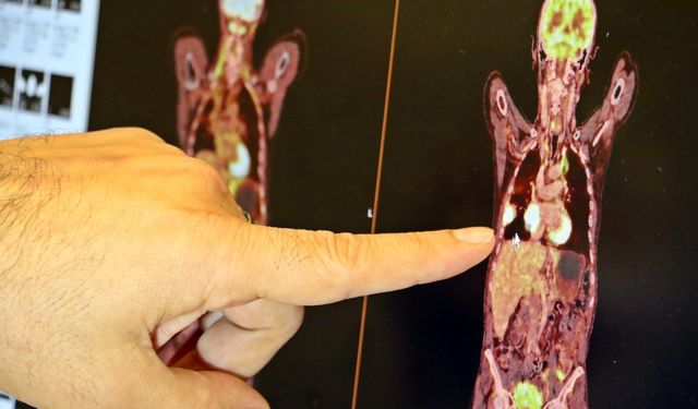 Prof. Dr. Ali Murat Tatlı’dan akciğer uyarısı