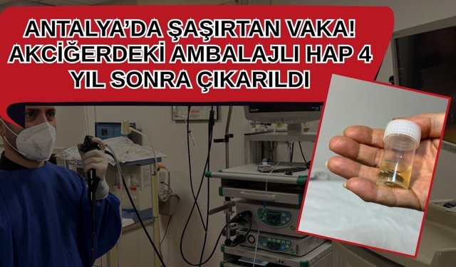 Antalya’da şaşırtan vaka! Akciğerdeki ambalajlı hap 4 yıl sonra çıkarıldı