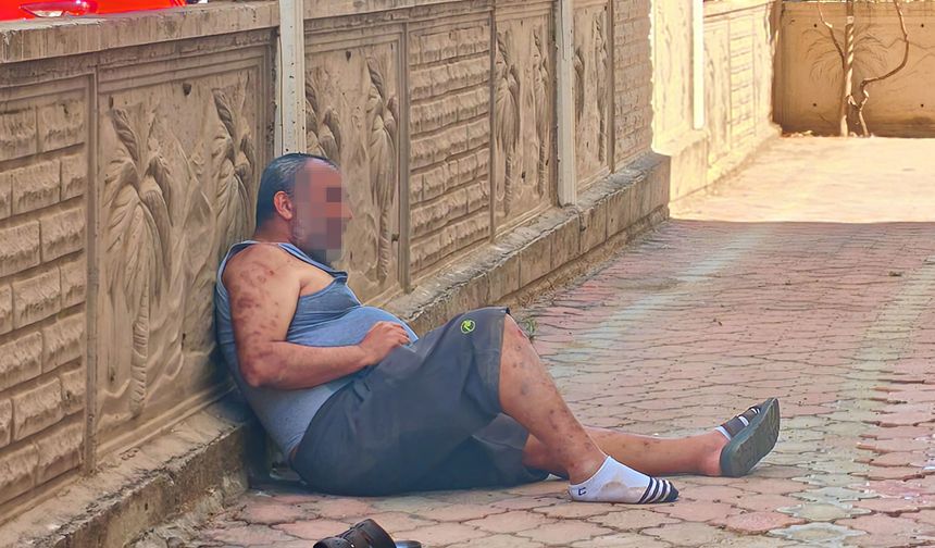 Antalya’da akıl almaz olay… “Benim mallarımı aldılar” diyerek kendini yakmak istedi